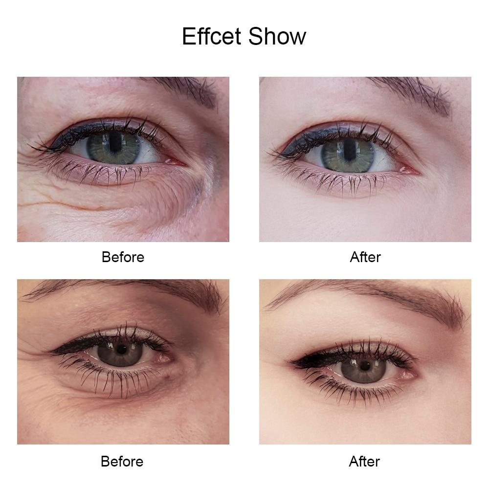 Black Gold Pearl Collagen Mask Natural Moisturizing Gel Eye bag 60 patches - MomProStore
