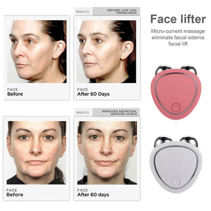 Facial Rejuvenation & Skin Tightening Massager