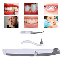 Load image into Gallery viewer, Electric Ultrasonic Tooth Stain Eraser Plaque Remover - MomProStore 