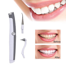 Load image into Gallery viewer, Electric Ultrasonic Tooth Stain Eraser Plaque Remover - MomProStore 