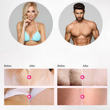 Load image into Gallery viewer, Home Electric Laser Hair Removal