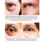 Magic Eye Cream Dark Circle Anti-Wrinkle Eye Bags Repair Crocodile Eye Serum Peptide Collagen Serum Eye Care